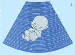 Ultrasound Baby